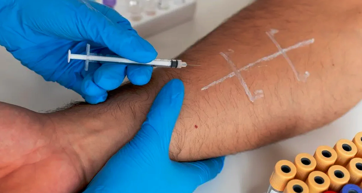 skin prick testing  in Mcallen